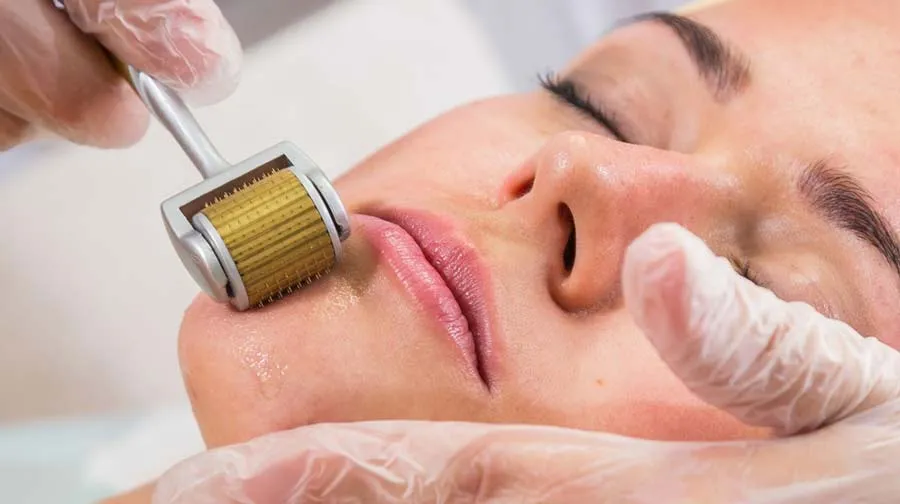15 Cách trị sẹo rỗ do mụn hiệu quả và thân thiện với làn da hiện nay