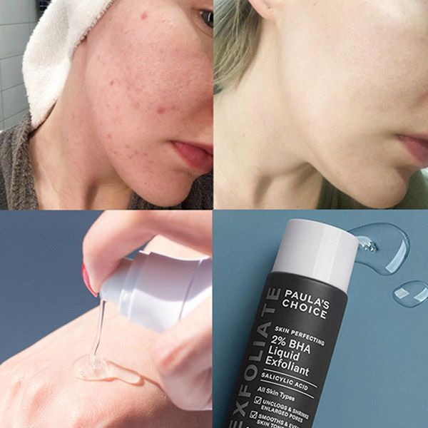 Dung Dịch Hỗ Trợ Loại Bỏ Tế Bào Chết Paula's Choice Skin Perfecting 2% BHA Liquid Exfoliant 118 ml - Mỹ phẩm - Vua Hàng Hiệu