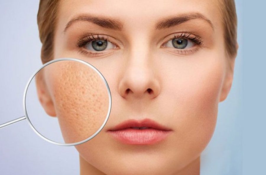 Ăn gì để sẹo lõm nhanh đầy? 10 món ăn tốt cho da bị sẹo lõm - 1