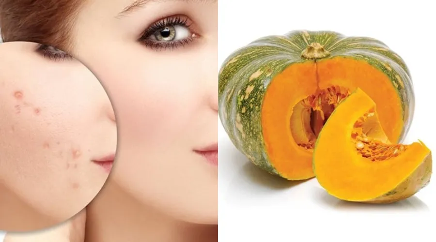 Ăn gì để sẹo lõm nhanh đầy? 10 món ăn tốt cho da bị sẹo lõm - 9