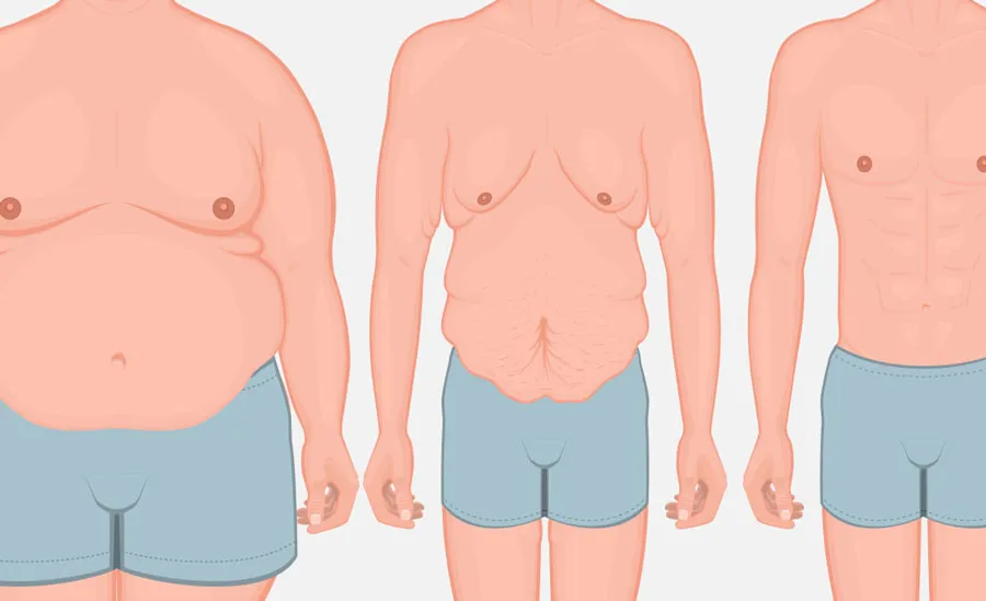 9 Cách khắc phục da bị nhão xệ sau giảm cân và sinh con - 9