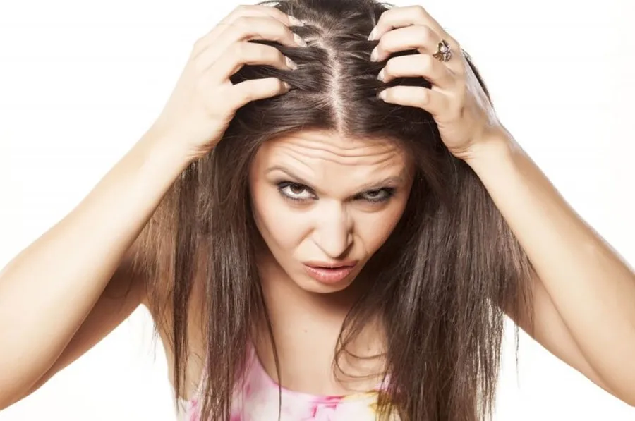 Top 10 cách trị ngứa da đầu tận gốc nhanh chóng