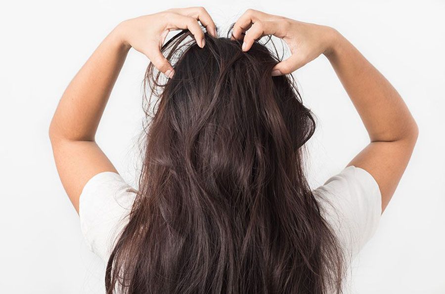 Top 10 cách trị ngứa da đầu tận gốc nhanh chóng