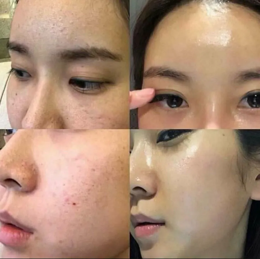 Hướng dẫn peel da tại nhà cho người mới giúp da trắng đẹp mịn màng