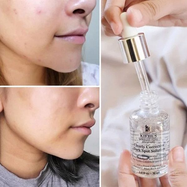 Serum Hỗ Trợ Giảm Thâm Kiehl's Dark Spot Solution 30ml - Mỹ phẩm - Vua Hàng Hiệu
