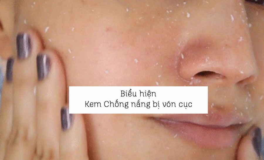 Top 11 kem chống nắng không bị bết dính hợp dùng mùa hè