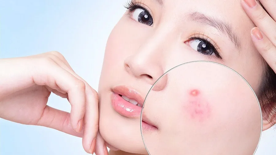 Top 11 nước tẩy trang cho da dầu mụn nhạy cảm được nhiều khách hàng yêu thích 2025