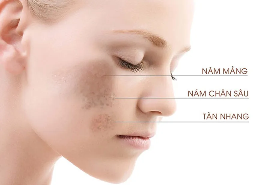 Review 6 sản phẩm Obagi trị nám tàn nhang hiệu quả - 9