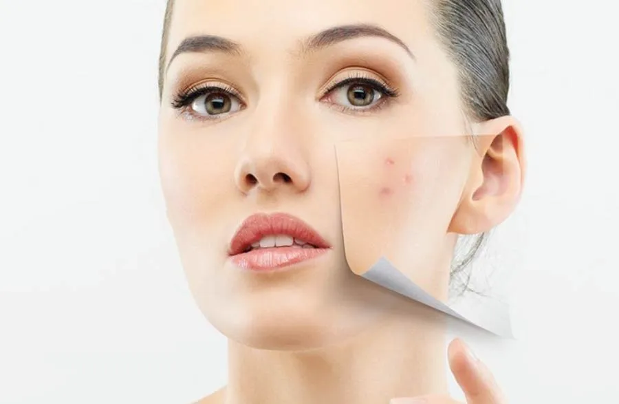 Top 10 lọ sữa rửa mặt dịu nhẹ cho da dầu mụn chất lượng tốt 2025 - 1