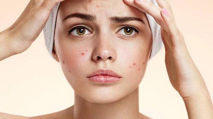 Top 11 nước tẩy trang cho da dầu mụn nhạy cảm được nhiều khách hàng yêu thích 2025