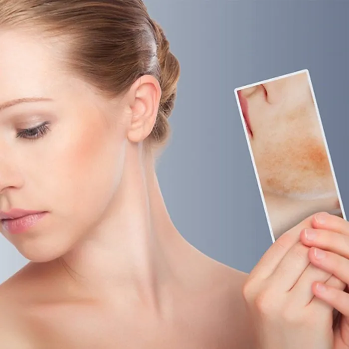Cách chăm sóc da bị dị ứng mỹ phẩm giúp da nhanh lành hiệu quả