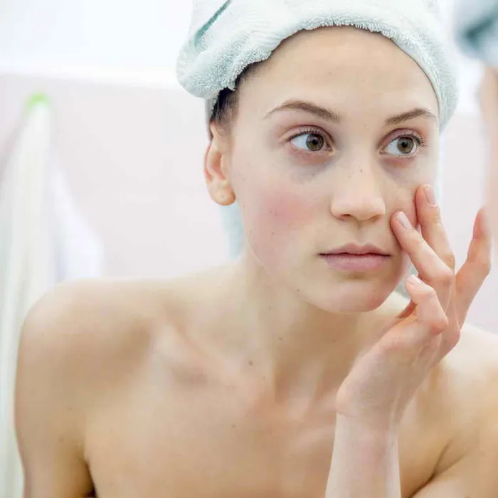 Cách chăm sóc da bị dị ứng mỹ phẩm giúp da nhanh lành hiệu quả