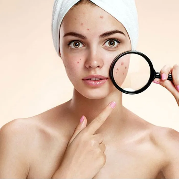 9 cách thải độc cho da mặt tại nhà đơn giản, giúp da khỏe đẹp