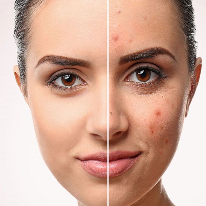 Chăm sóc da tuổi 30: Bí quyết lưu giữ làn da trẻ mãi không già - 1