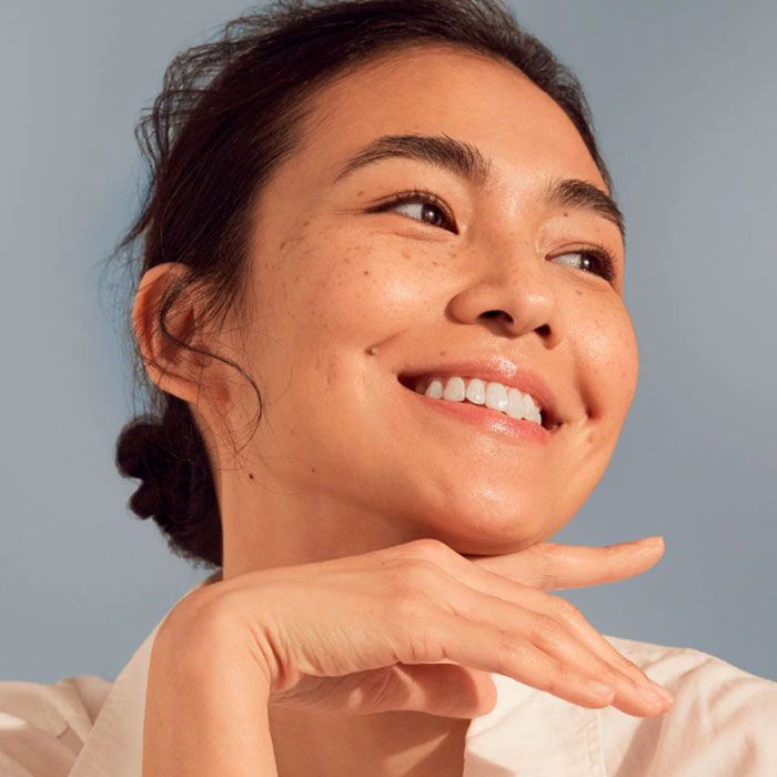 Da không đều màu là gì? 7 cách làm đều màu da hiệu quả - 5