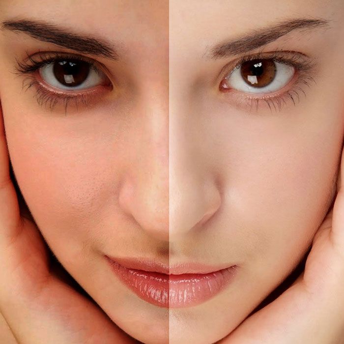 Da không đều màu là gì? 7 cách làm đều màu da hiệu quả - 16