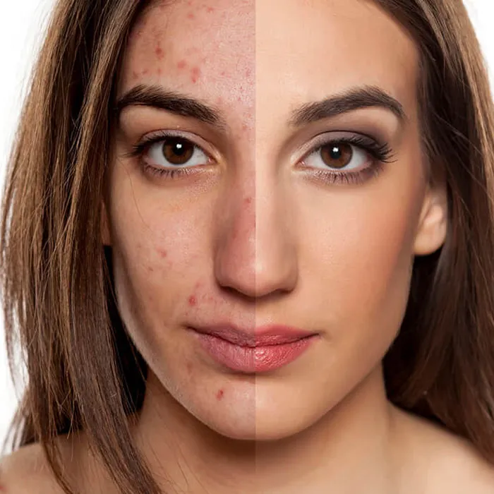 Da không đều màu là gì? 7 cách làm đều màu da hiệu quả - 3