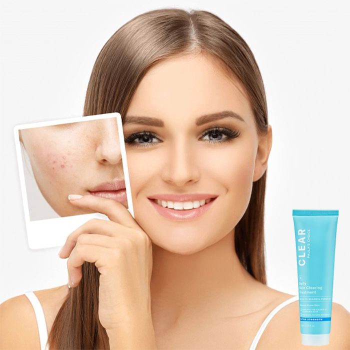 Review 3 loại kem hỗ trợ làm sạch mụn cho da dầu đem lại hiệu quả rõ rệt sau 1 tuần - 3