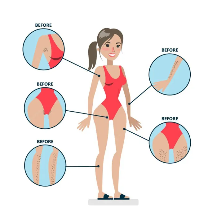 5 loại máy triệt lông cá nhân nhỏ gọn, triệt tận gốc chân lông