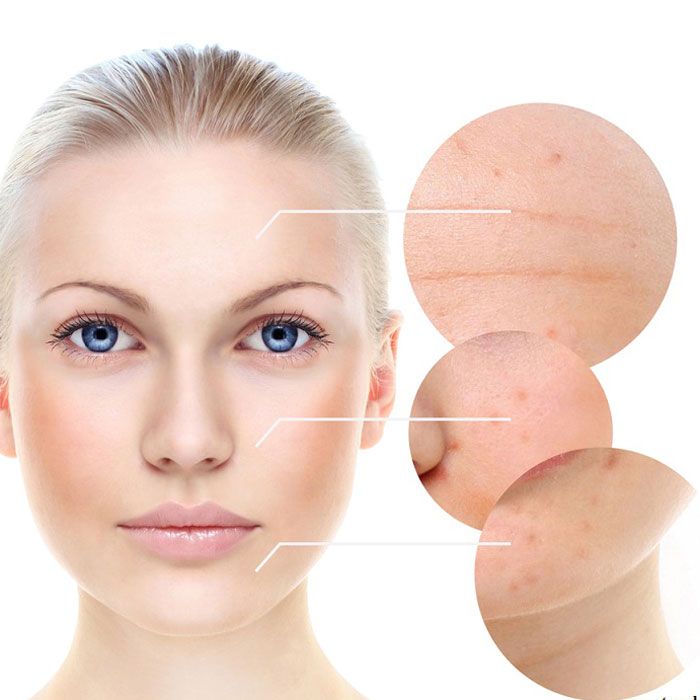 Melanin là gì? Lợi ích với làn da và những rối loạn liên quan - 12