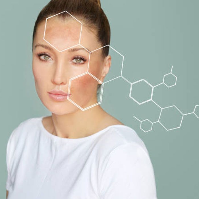 Melanin là gì? Lợi ích với làn da và những rối loạn liên quan - 7