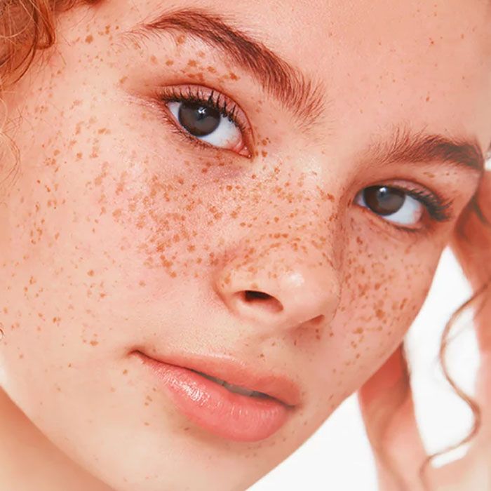 Melanin là gì? Lợi ích với làn da và những rối loạn liên quan - 8