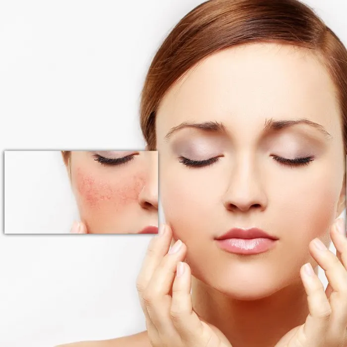 5 cách nhận biết loại da mặt đơn giản, đảm bảo chính xác