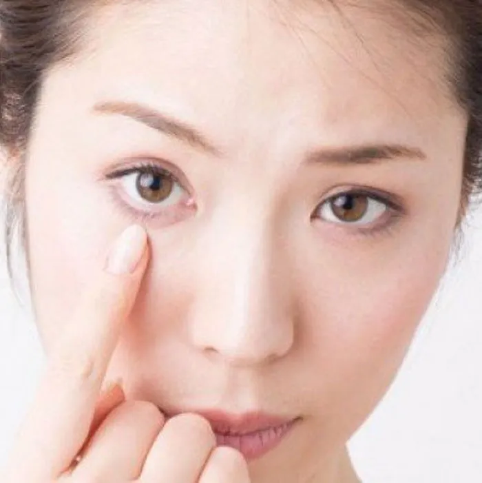 Top 10 cách chữa sụp mí mắt tại nhà hiệu quả tốc độ vượt trội