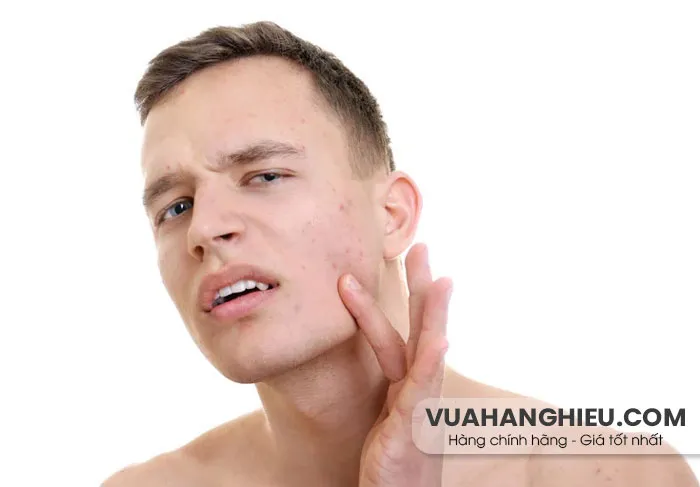 9 cách chăm sóc da mụn cho nam hiệu quả nhanh chóng