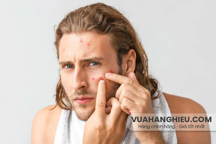 9 cách chăm sóc da mụn cho nam hiệu quả nhanh chóng
