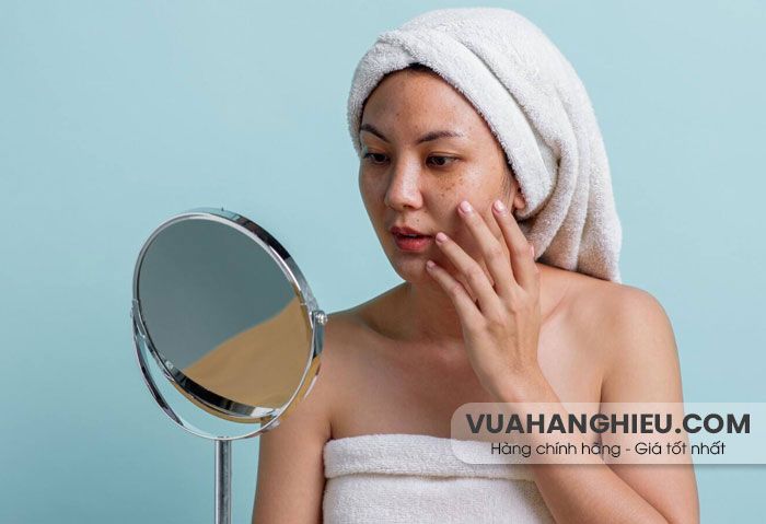 Cách ngăn ngừa nám da khi mang thai: Nguyên nhân, biện pháp và phòng ngừa