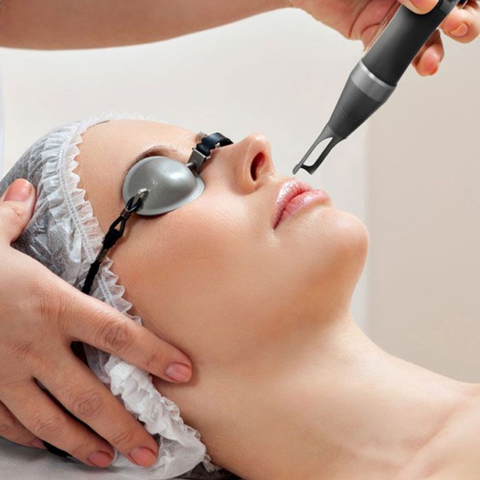 17 cách trị thâm hai bên mép miệng hiệu quả nhanh chóng