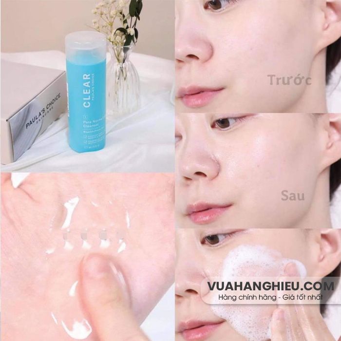 Review sữa rửa mặt Paula’s Choice Clear Pore Normalizing Cleanser có tốt không? - 6