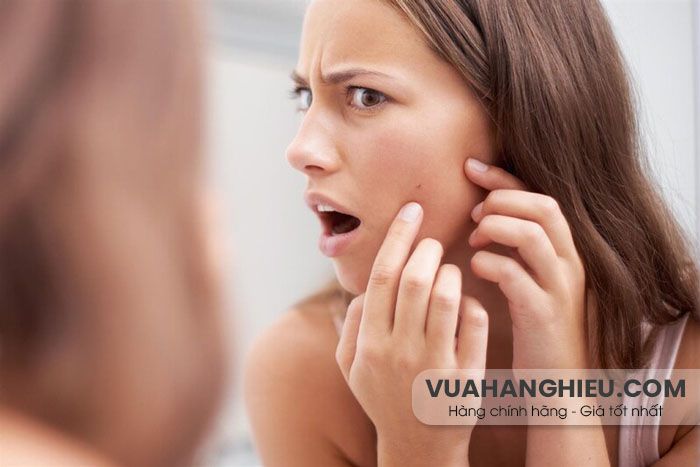 24 cách hỗ trợ làm sạch mụn ẩn bằng thiên nhiên thân thiện với làn da và hiệu quả tại nhà