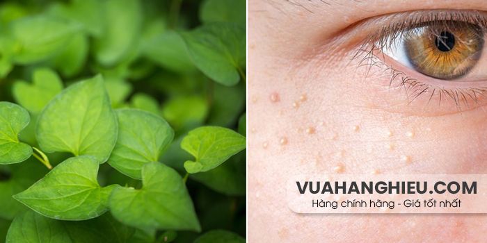 24 cách hỗ trợ làm sạch mụn ẩn bằng thiên nhiên thân thiện với làn da và hiệu quả tại nhà