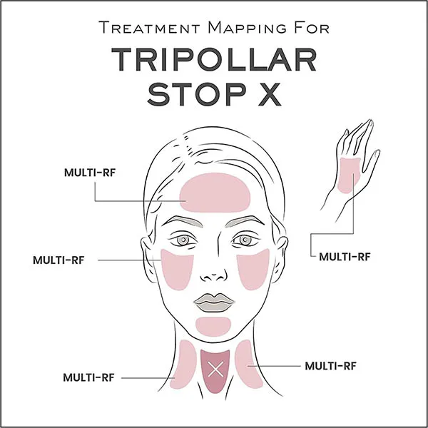 Máy Massage TriPollar Stop X Hỗ Trợ Làm Săn Chắc Và Trẻ Hóa Da (Kèm Gel Dưỡng) - Máy massage - Vua Hàng Hiệu