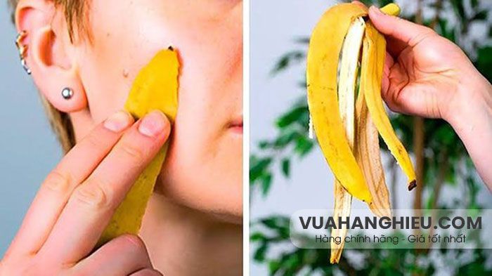 7 cách dùng vỏ chuối để hỗ trợ làm sạch mụn và thâm sẹo hiệu quả