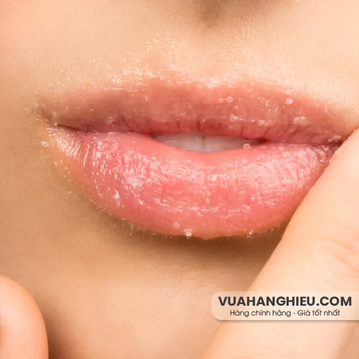 17+ cách trị môi khô bong tróc nứt nẻ hiệu quả sau 1 đêm