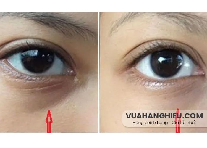 Review Kem mắt Estee Lauder Advanced Night Repair Eye có hiệu quả?