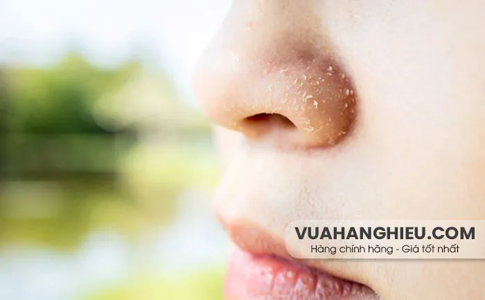 10 cách chăm sóc da khô xung quanh mũi hiệu quả nhanh chóng