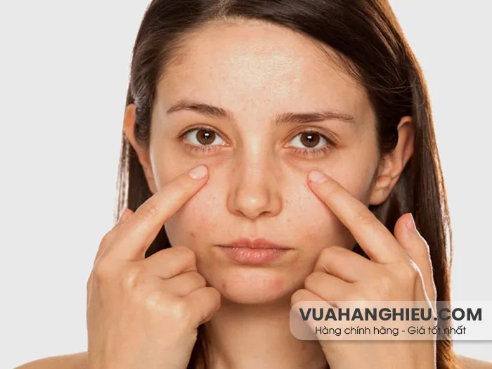 Mắt trũng là gì? Nguyên nhân và 11 biện pháp khắc phục từ thiên nhiên - 16