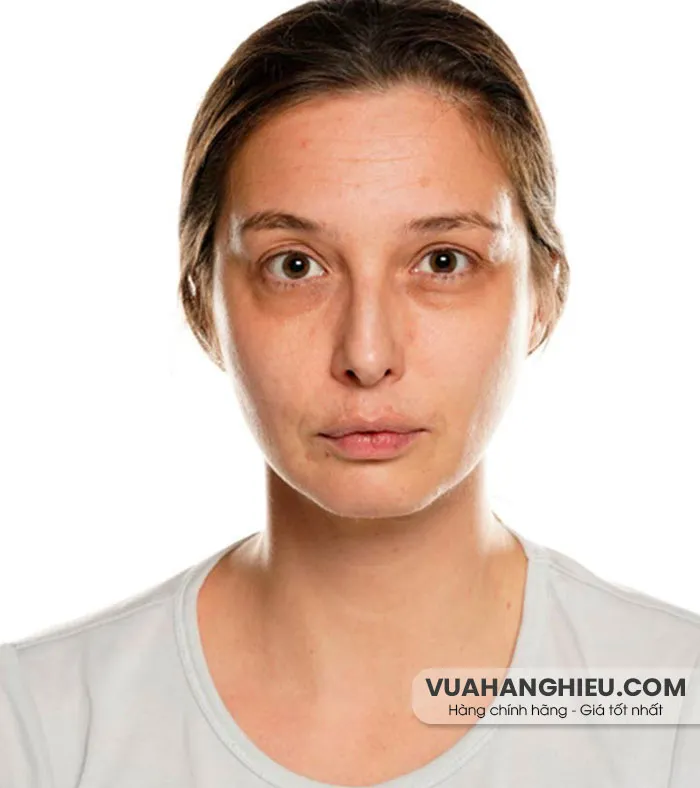 Mắt trũng là gì? Nguyên nhân và 11 biện pháp khắc phục từ thiên nhiên - 1