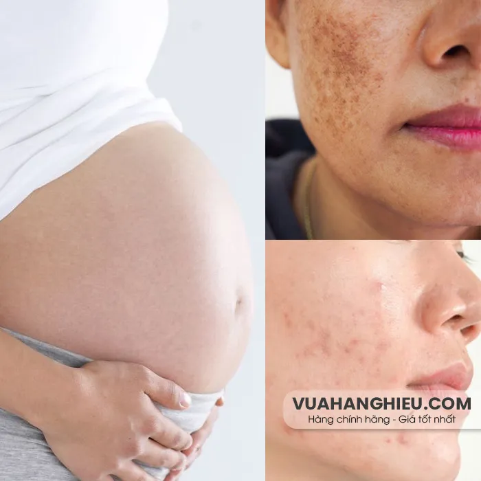10 loại mặt nạ cho bà bầu thân thiện với làn da, đáng mua