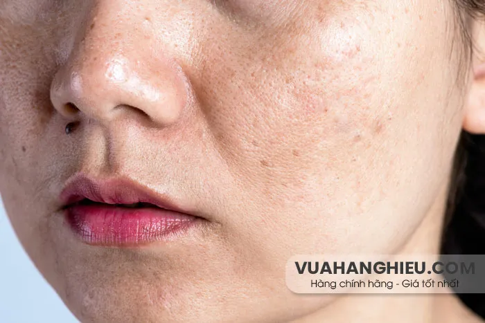 10 Sản phẩm skincare cho da khô lỗ chân lông to chất lượng tốt