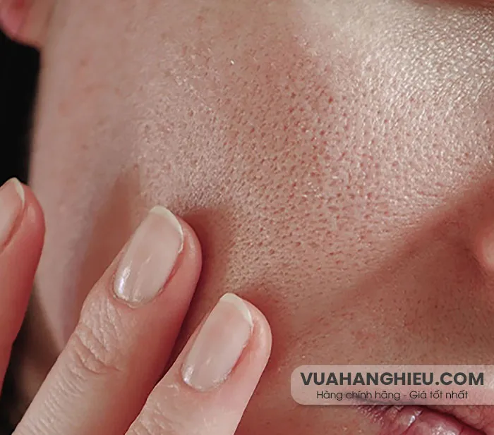 10 Sản phẩm skincare cho da khô lỗ chân lông to chất lượng tốt