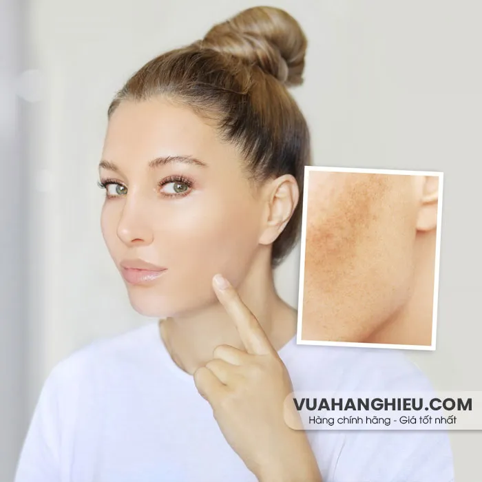 7 cách chăm sóc da không đều màu thân thiện với làn da, hiệu quả