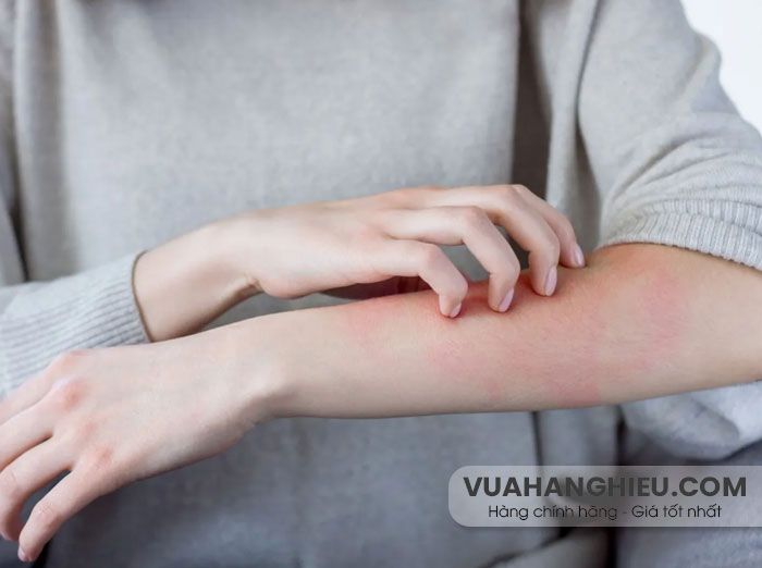 10 mẹo khắc phục da bị khô ngứa khó chịu vào mùa đông - 1