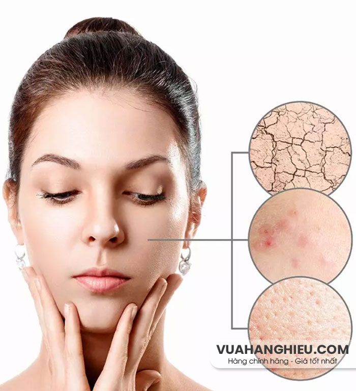 12 cách hỗ trợ cải thiện da khô mụn hiệu quả tại nhà từ thiên nhiên - 1