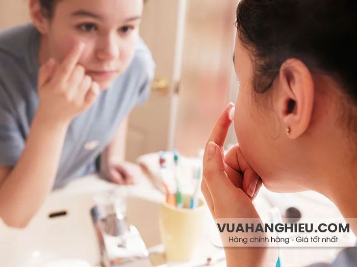 12 cách hỗ trợ cải thiện da khô mụn hiệu quả tại nhà từ thiên nhiên - 17