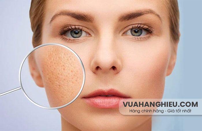 9 loại serum trị sẹo rỗ giúp làm đầy, tái tạo da mặt được nhiều khách hàng yêu thích   - 1
